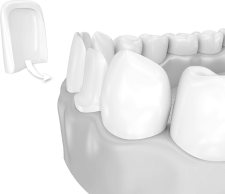 Лечение и удаление молочных зубов