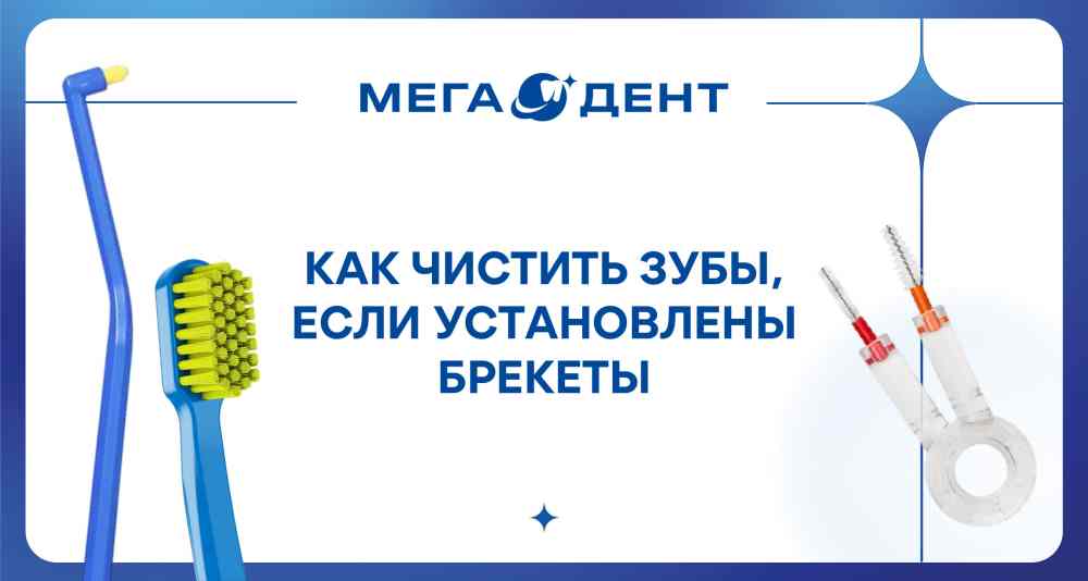 Чистка при брекетах
