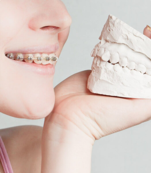 Гипсовая модель зуба