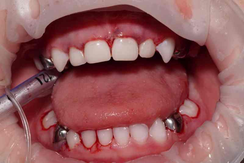 После