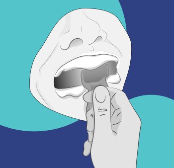 Как связаны полость рта и ЖКТ: что будет, если вовремя не лечить зубы